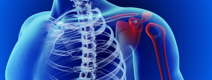 Rotator Cuff Injuries