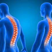 bad posture symptoms and how to fix